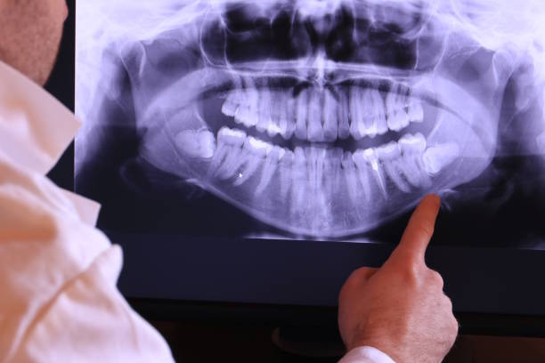 Best Emergency Tooth Extraction in Homerville, GA
